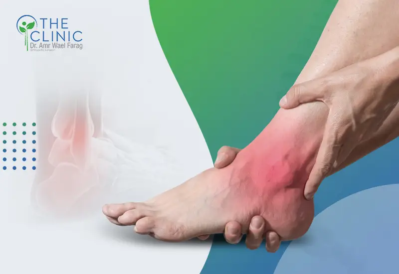 أعراض الشوكة العظمية في الكعب وأسبابها الشائعة