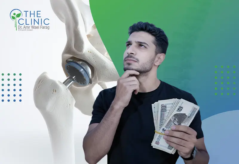تكلفة عملية تغيير مفصل الفخذ 2026 والعوامل المؤثرة فيها